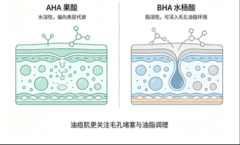 看懂水杨酸功效就明白，油痘肌祛痘为何选施颜适水杨酸棉